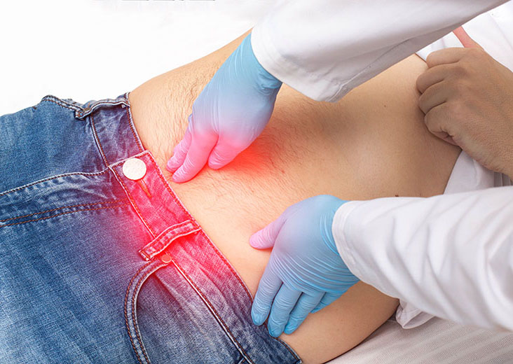 Expert Hernia Surgery by Dr. Mahmoud Tabbal - Hernia Specialist Dubai